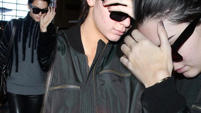 kendall jenner runway pimples
