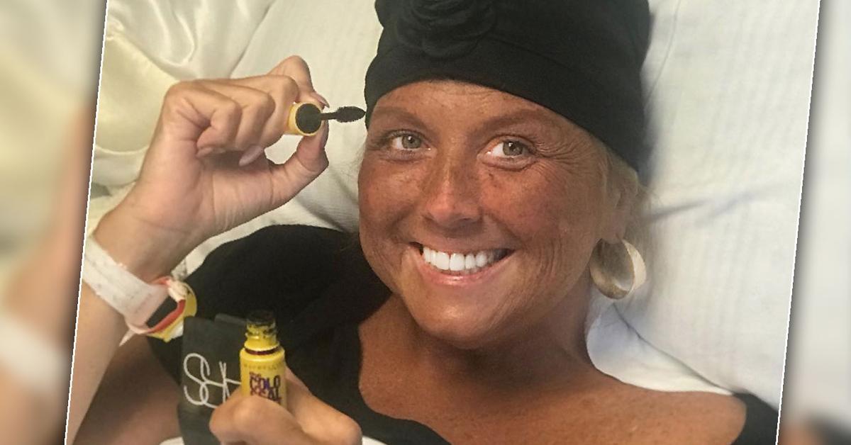 Abby Lee Miller Undergoes Five Rounds Of Chemo(00)