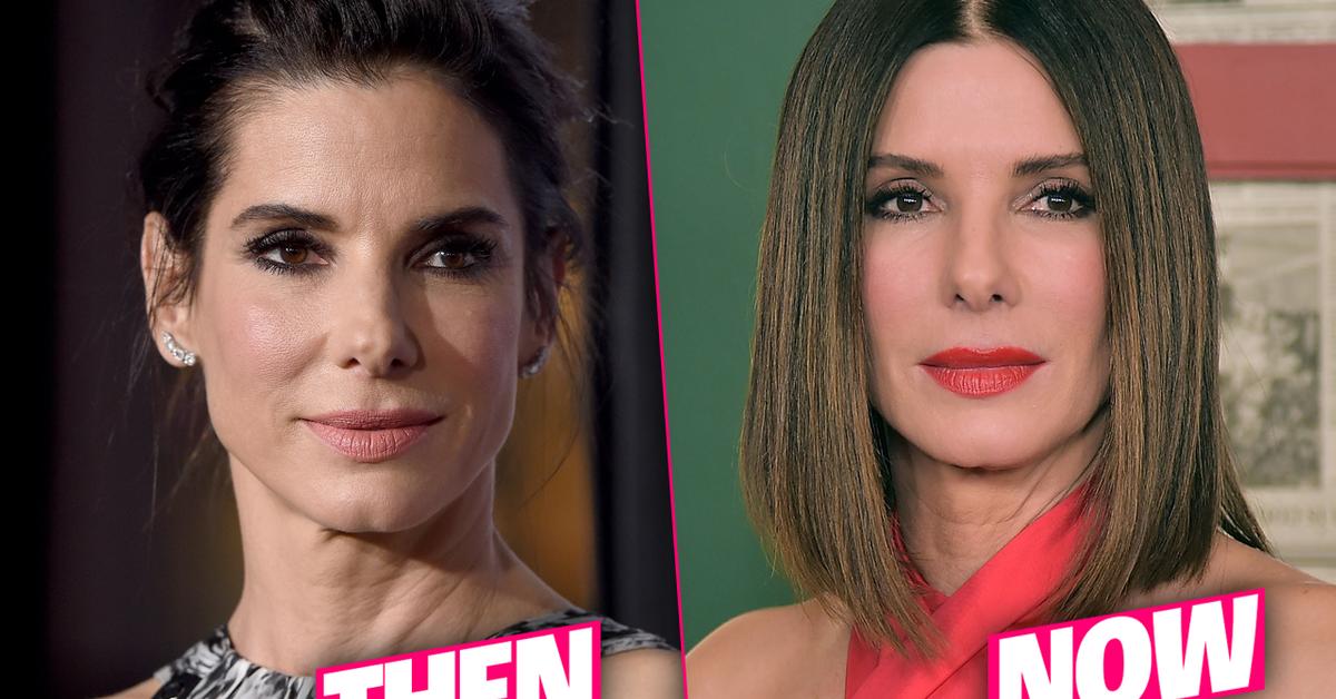 Sandra Bullock Frozen Face Result Of 'Fillers & Botox' Overload, Docs Claim