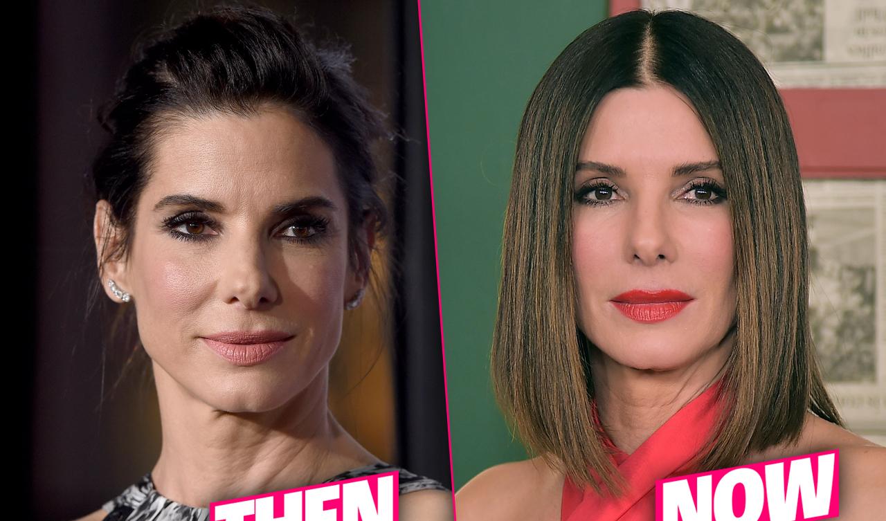 Sandra Bullock Frozen Face Result Of 'Fillers & Botox' Overload, Docs Claim