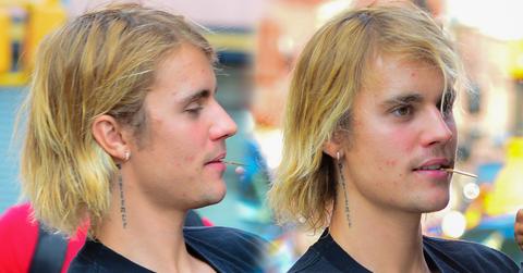 Justin Bieber Pimple Breakouts Hailey Baldwin Engagement