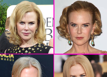 //nicole kidman botox wenn