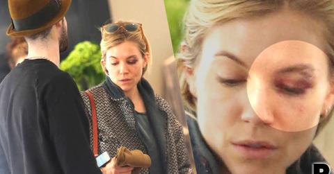 Sienna Miller Black Eye
