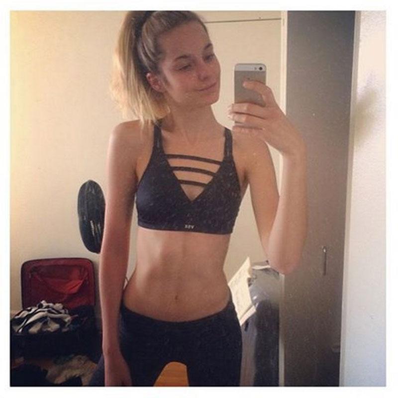 Bridget Malcolm Victorias Secret Model Skinny Shaming