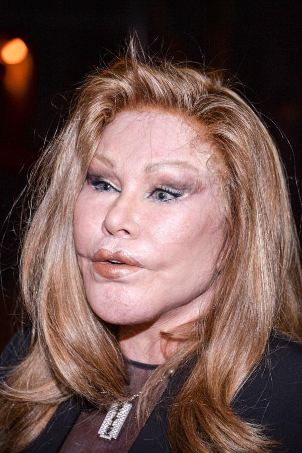 Jocelyn Wildenstein Plastic Surgery Photos