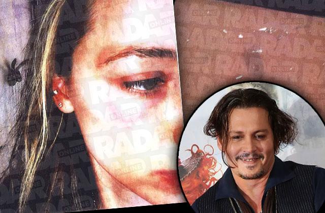 Amber Heard Johnny Depp Abuse Claims Photo Damage