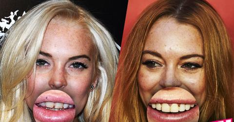 //lindsay lohan teeth rotted bad pp