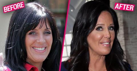 //Patti Stanger Plastic Surgery Makeover pp