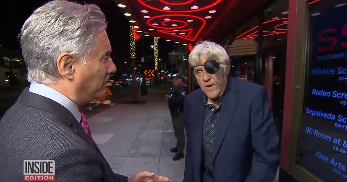 jay leno sports eye patch black and blue bruises after downhill fall