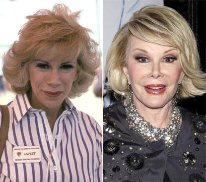 //joan rivers addicted to plastic surgery