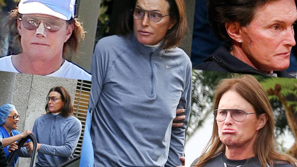 How He’ll Do It! Doctors Reveal Steps Bruce Jenner Will Likely Take In