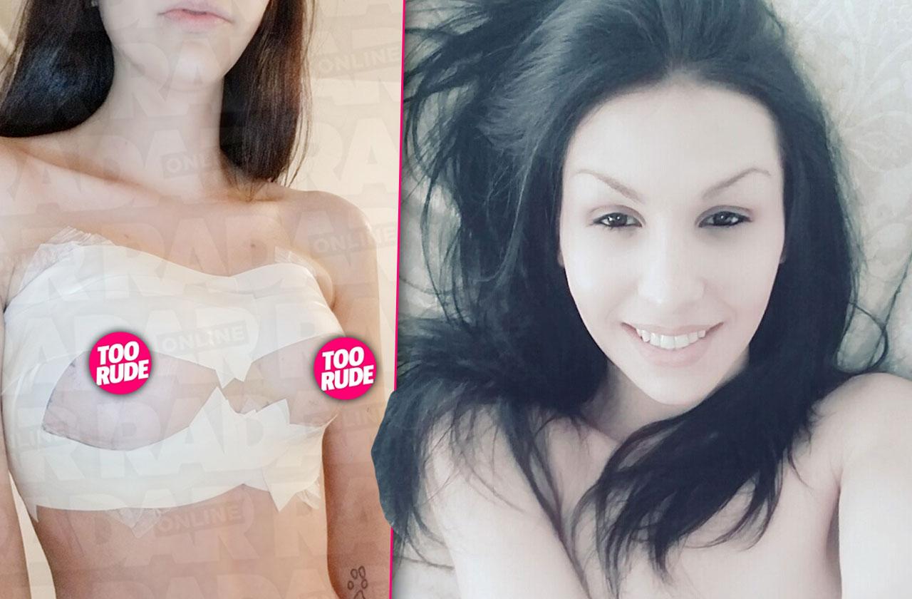 True or Not? Young woman undergoes breast plastic surgery to add a third  breast. – Aristocrat Plastic Surgery