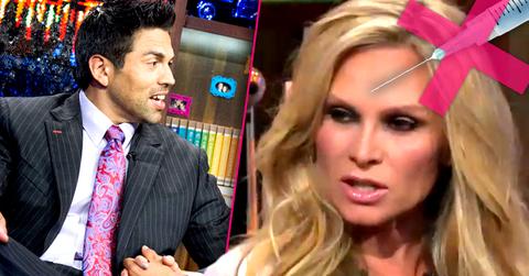 //tamra barney eddie judge botox cosmetic fillers pp sl