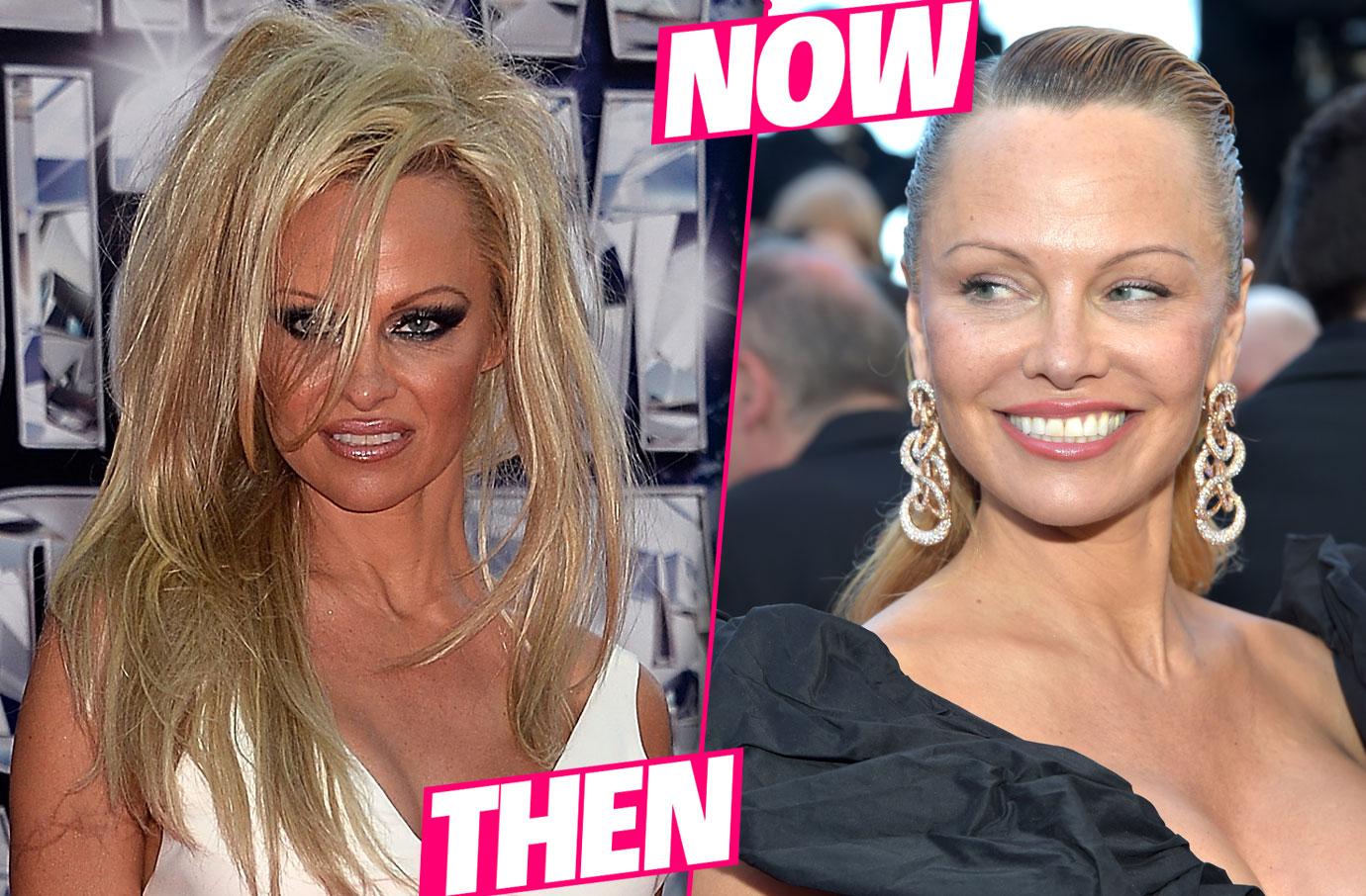 Pamela Andersons Plastic Surgery Makeover Exposed By Top Docs 