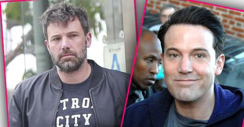 Ben Affleck Plastic Surgery Botox