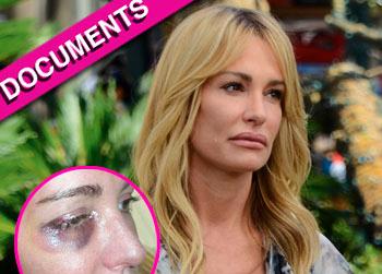 //taylor armstrong abuse medical record