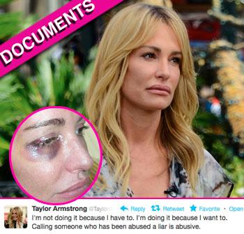 //taylor armstrong abuse medical record
