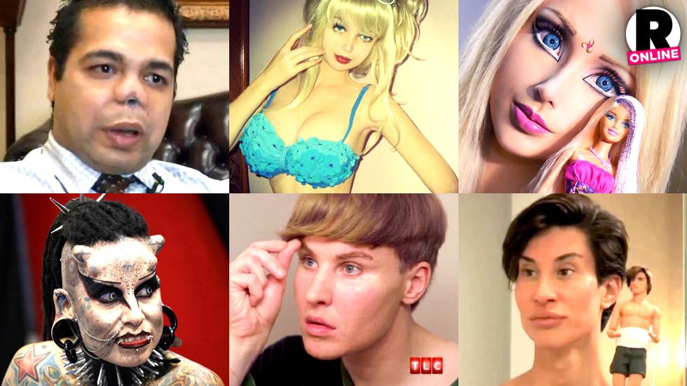 15 Celebrity Plastic Surgery Disasters 