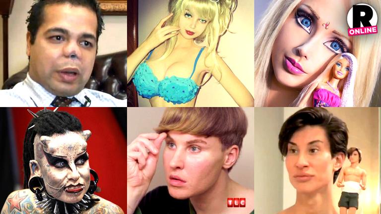 15 Extreme Real Life Plastic Surgery Disasters