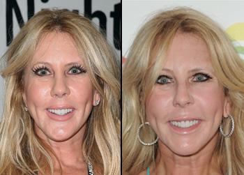 //pp_vicki gunvalsonface_wenn_splash