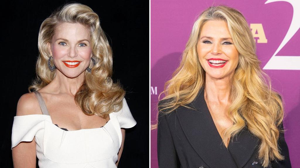 christie brinkley plastic surgery Image 3