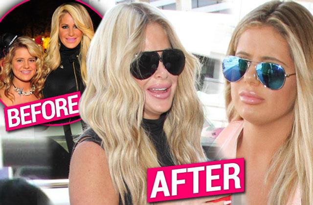 kim zolciak biermann plastic surgery lips brielle zolciak biermann