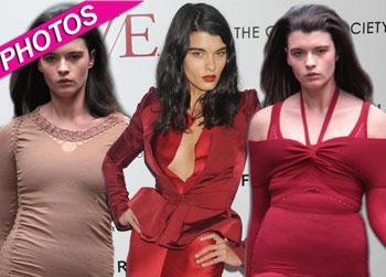 //crystal renn weight loss