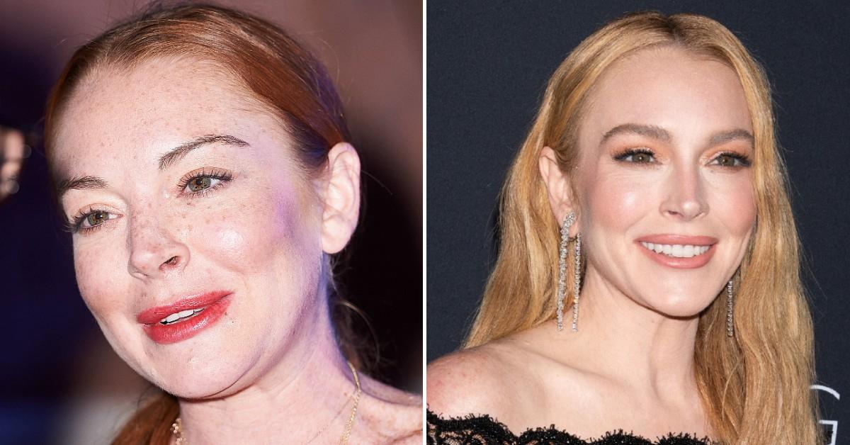 Secrets Behind Lindsay Lohan's 300k Face Revealed As She Heads for 40