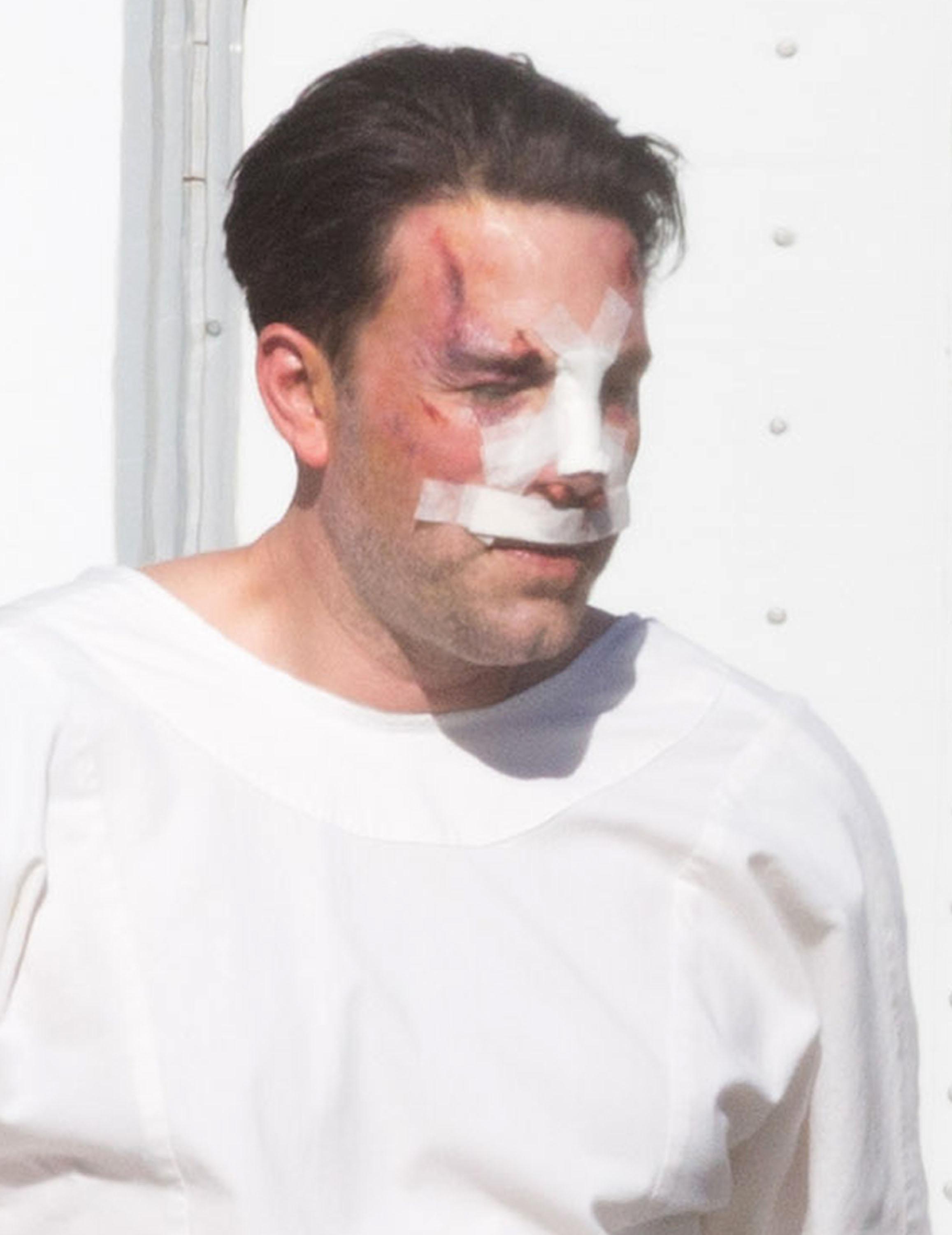 Ben Affleck Plastic Surgery Rumors Bloody On Set