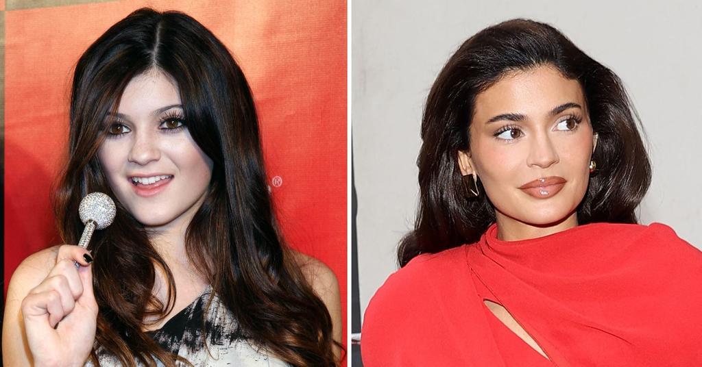 Kylie Jenner's Unfiltered Face: Plastic Surgeon Defends Hulu Star After ...