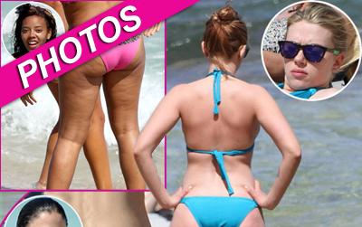 //celeb cellulite ffinfpcn post