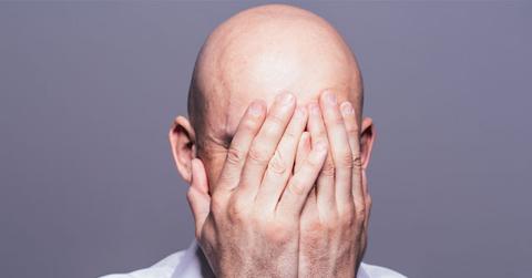 Bald Theif Steals Rogaine