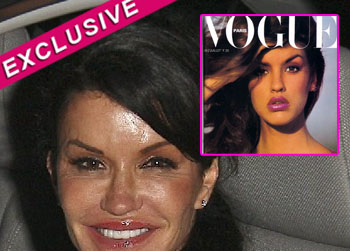 //janice dickinson plastic surgery