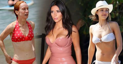 //celebrity liposuction plastic surgery