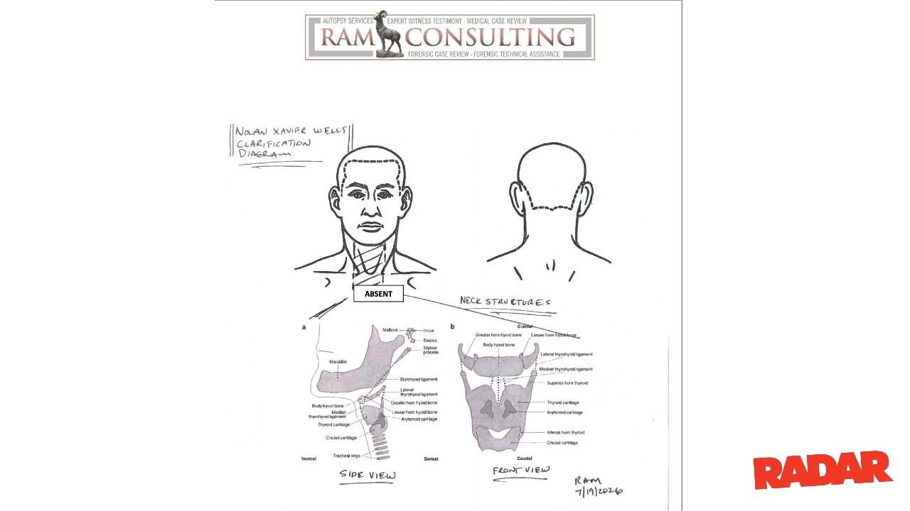 The pathologist was unable to determine a cause of death.