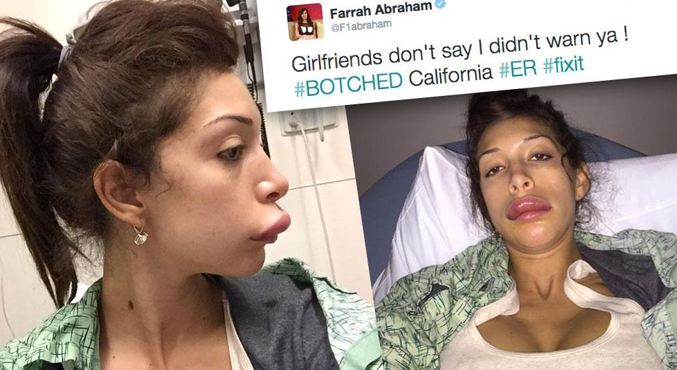 Teen Mom Turned Porn Star Farrah Abraham Tweets Botched Lips Pic Warns Her Girlfriends From The Er