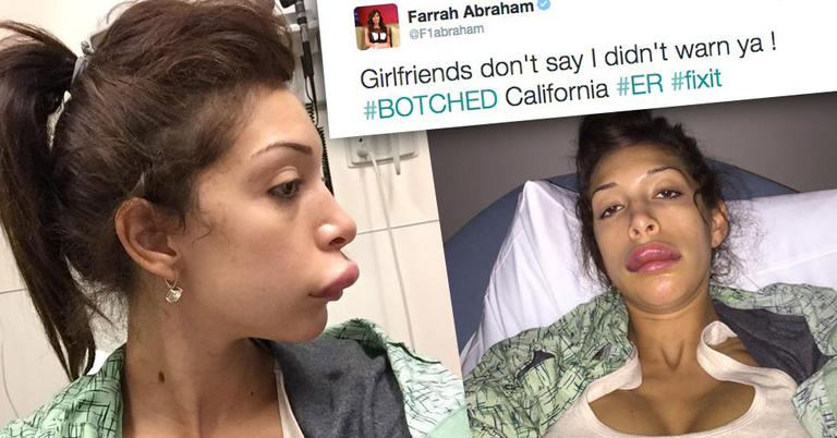 Teen Mom Turned Porn Star Farrah Abraham Tweets Botched Lips Pic Warns
