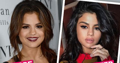 //Selena Gomez Lip Injections Plastic Surgery