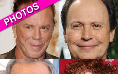 //plastic surgery men getty