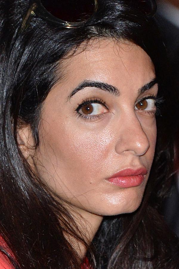 Plastic Is Perfect! Amal Clooney's Shocking New Face Is From Secret Surgery See Her