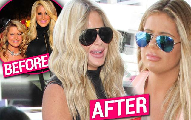 Kim And Brielle Zolciak Caught With Huge Lips After Plastic Surgeon Visit