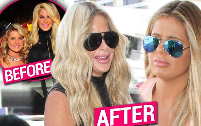 Kim And Brielle Zolciak Caught With Huge Lips After Plastic Surgeon Visit