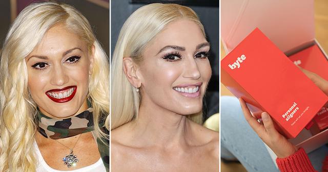 byte smile celeb teeth improve trend shop