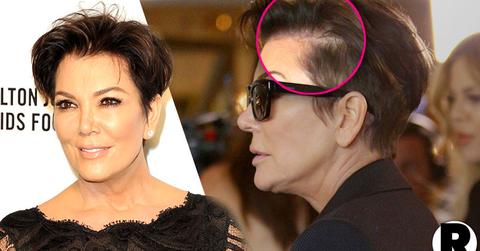 Kris Jenner Hair Loss