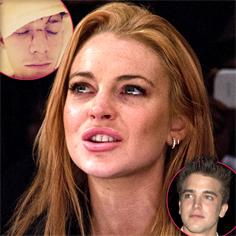 //lindsay lohan barron hilton plastic surgery fix face sq