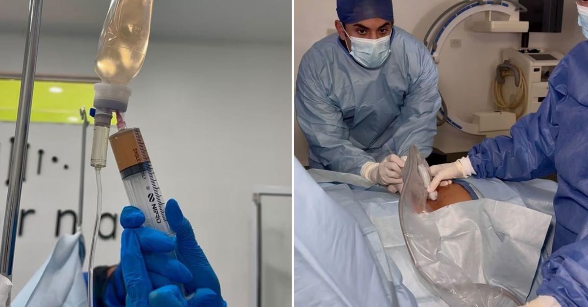kim kardashian mexico unusual treatment not approved