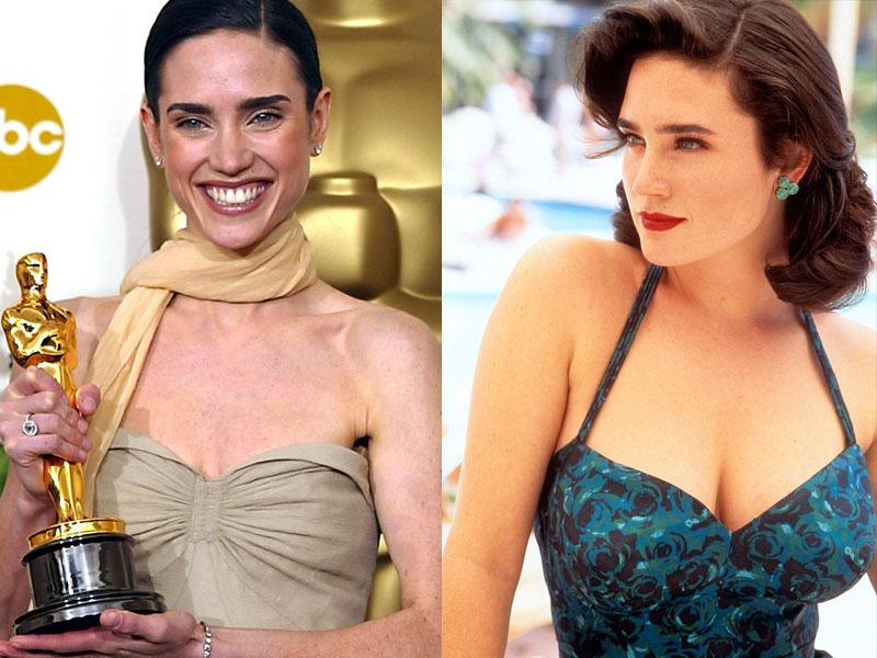 Celebs Who Underwent Breast Reduction Surgery