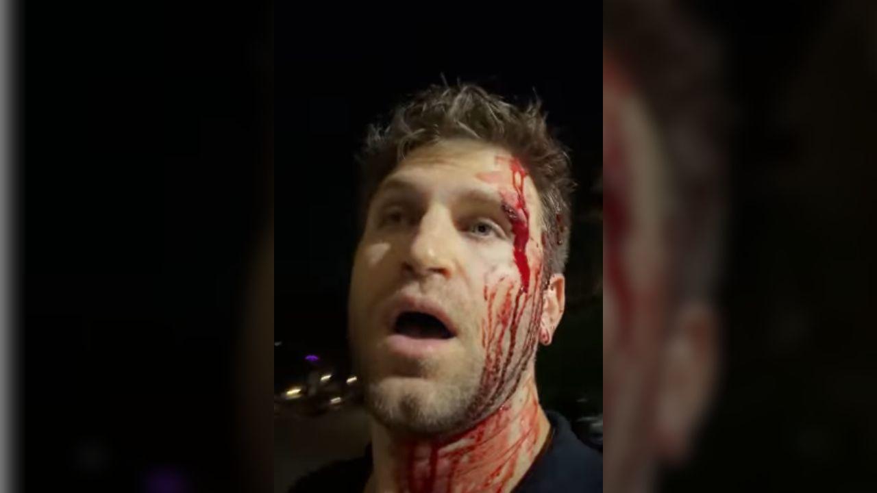 The star shared a video to his Instagram shortly after the attack. 