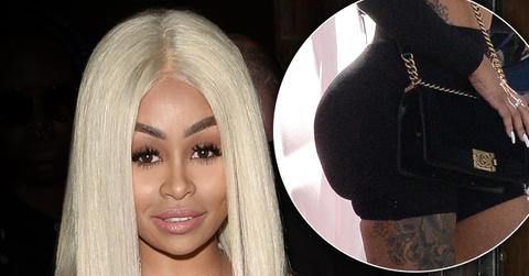 Blac Chyna Butt Reduction Plastic Surgery