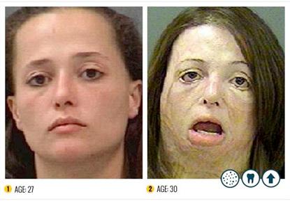 //meth abuse rehabs com